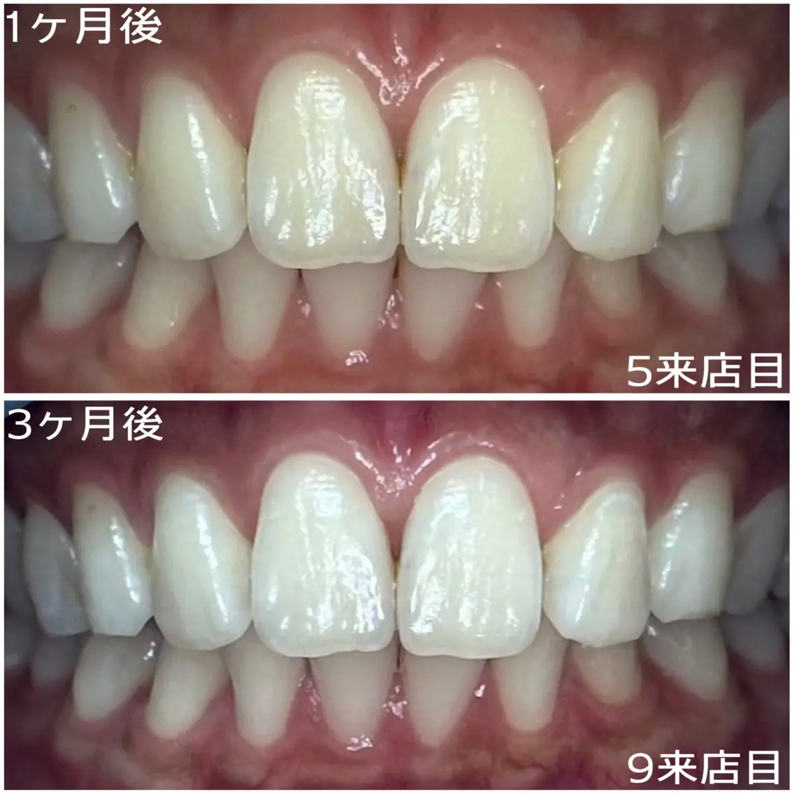 その他 White base ホワイトニングサロンのその他イメージ