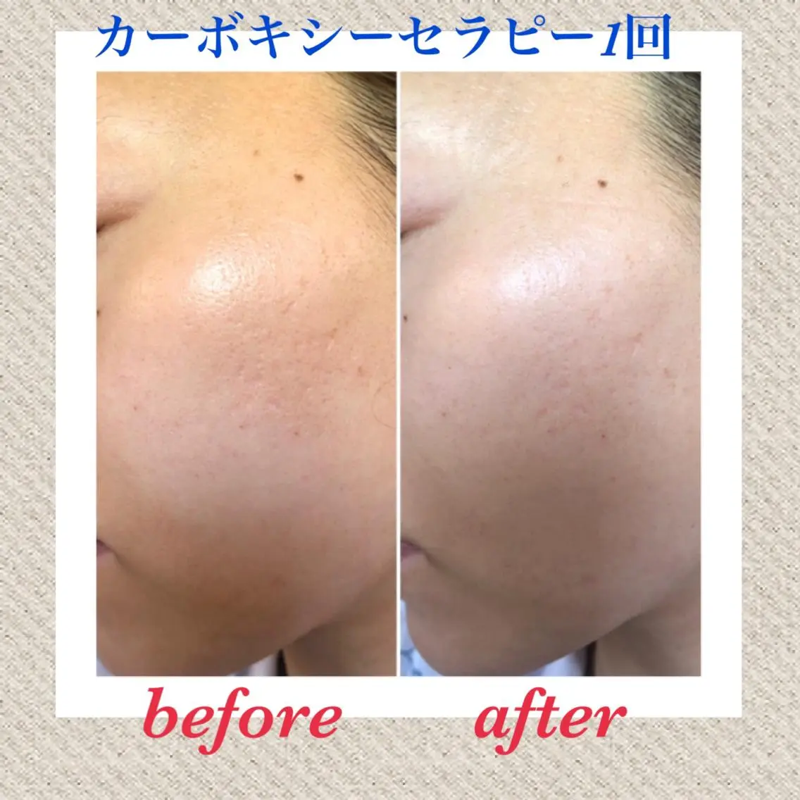 美ola ビオラのエステ・リラクイメージ