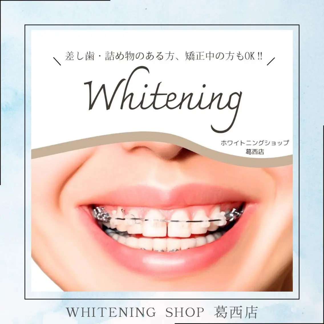 メンズ その他 ホワイトニング ショップ葛西店のその他イメージ
