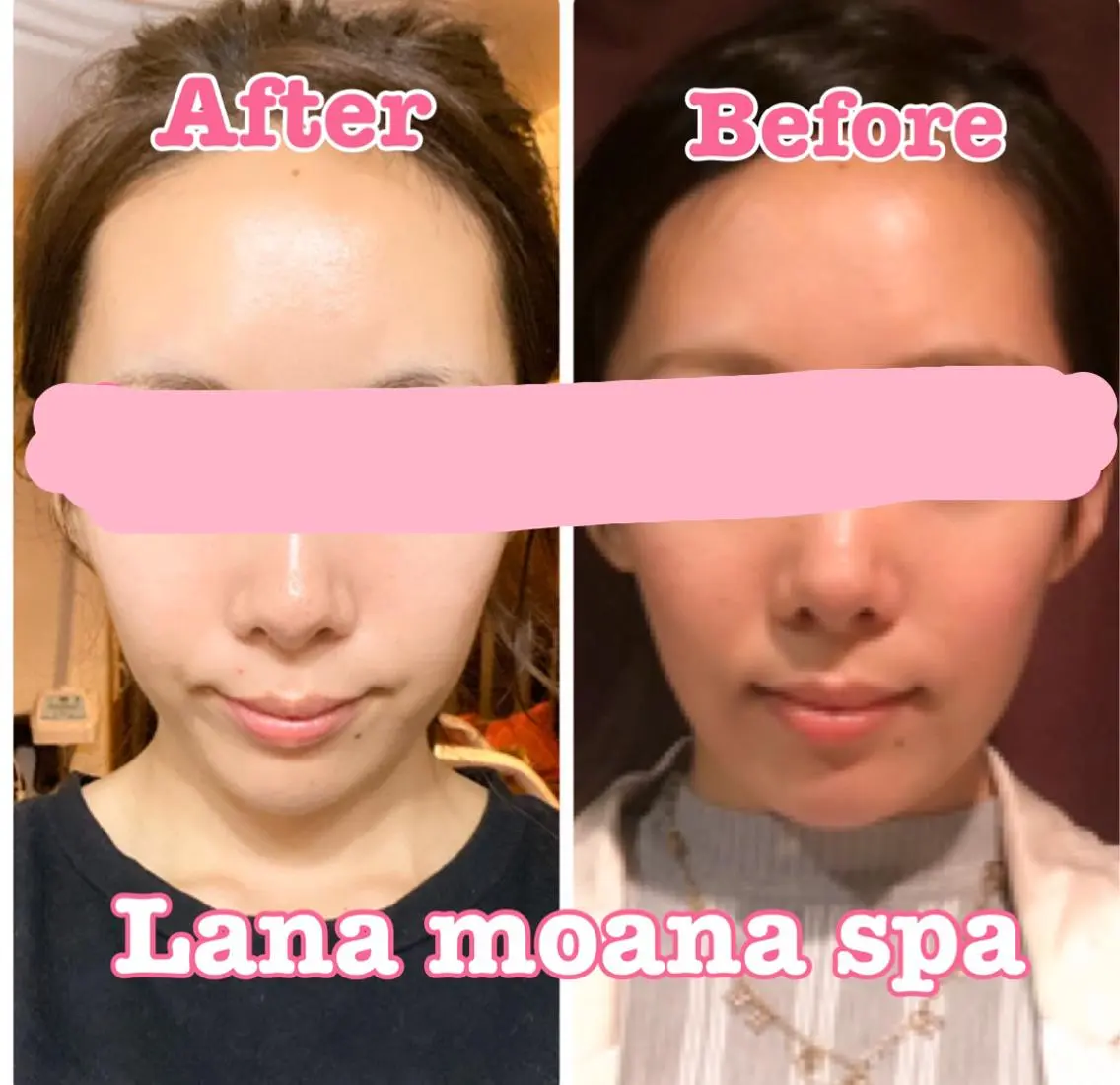 Lana moana spa🌺のエステ・リラクイメージ