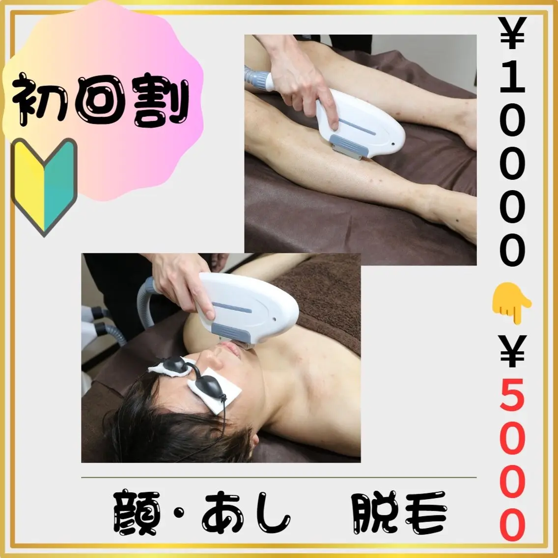 🔰新規割🔰【顔・脚 脱毛】 5️⃣0️⃣%割引❗️(#メンズ脱毛 #女性ウケ◎ #清潔感 #都度払い)の写真