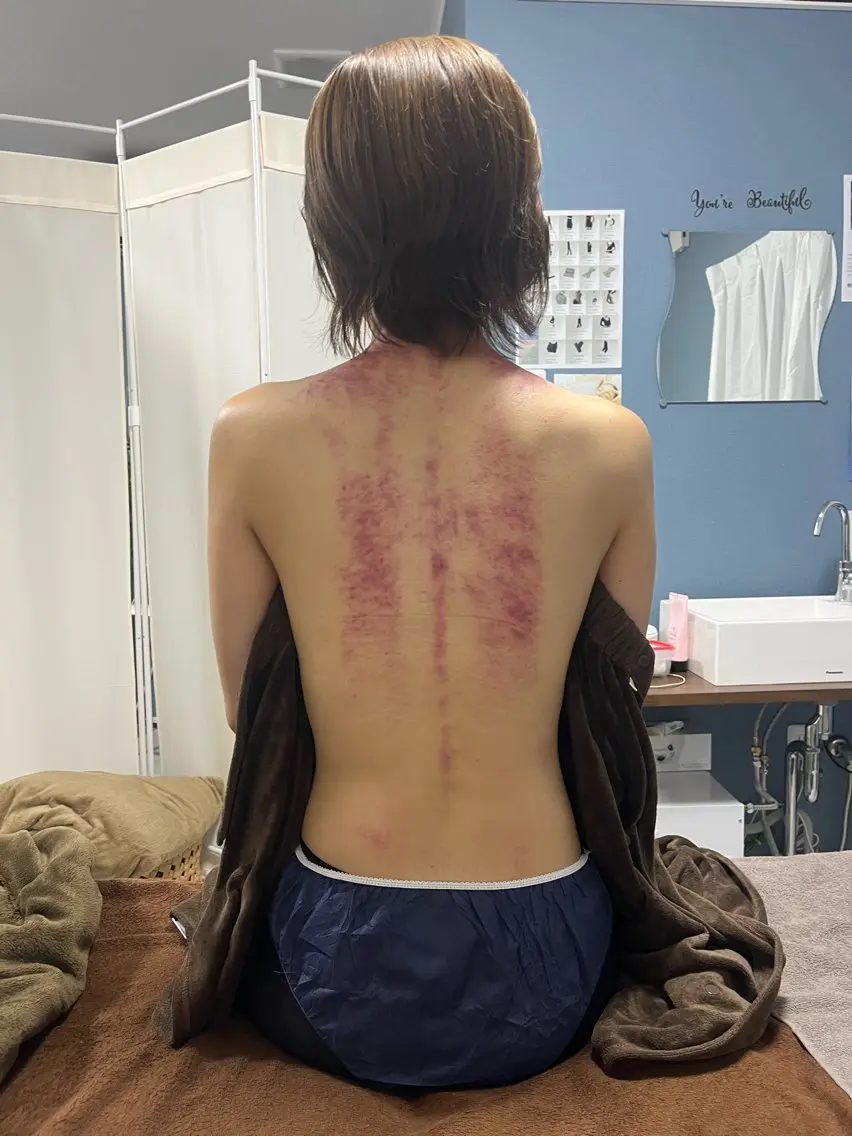 エステ リラク Lyf salon.のエステ・リラクイメージ