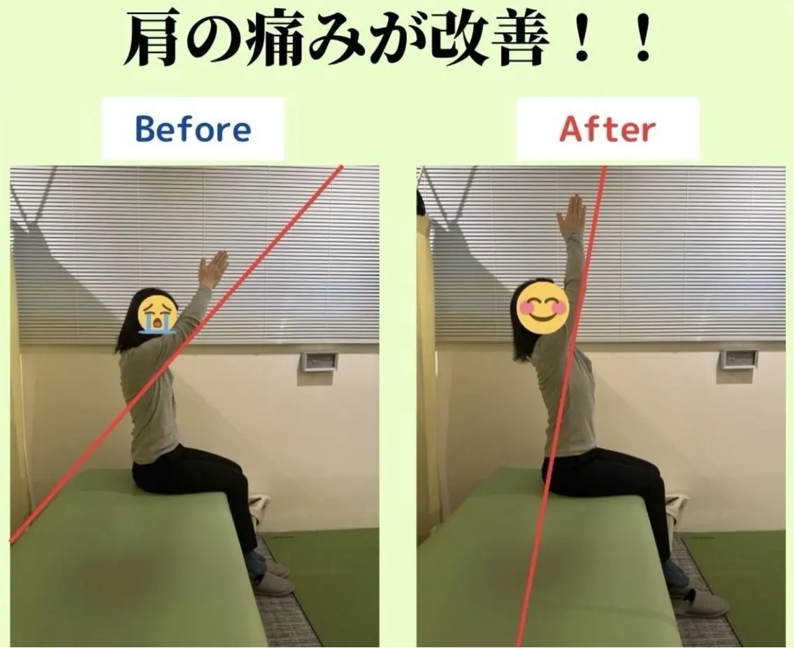 肩こり・首こり集中整体!ガンコな首肩こりが気になる方におすすめ!の写真
