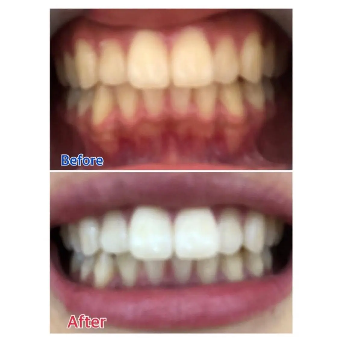 M渋谷 セルフホワイトニングのエステ・リラクイメージ