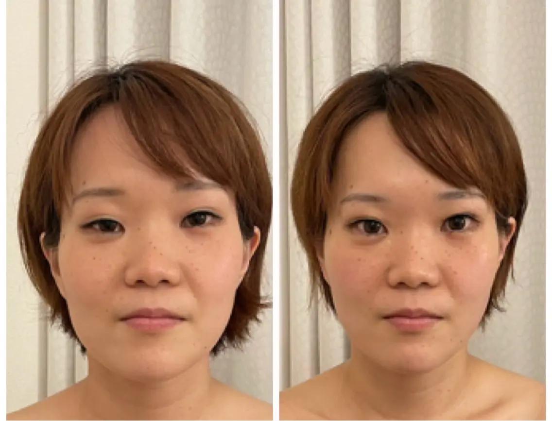 勝又 ゆきほのその他イメージ