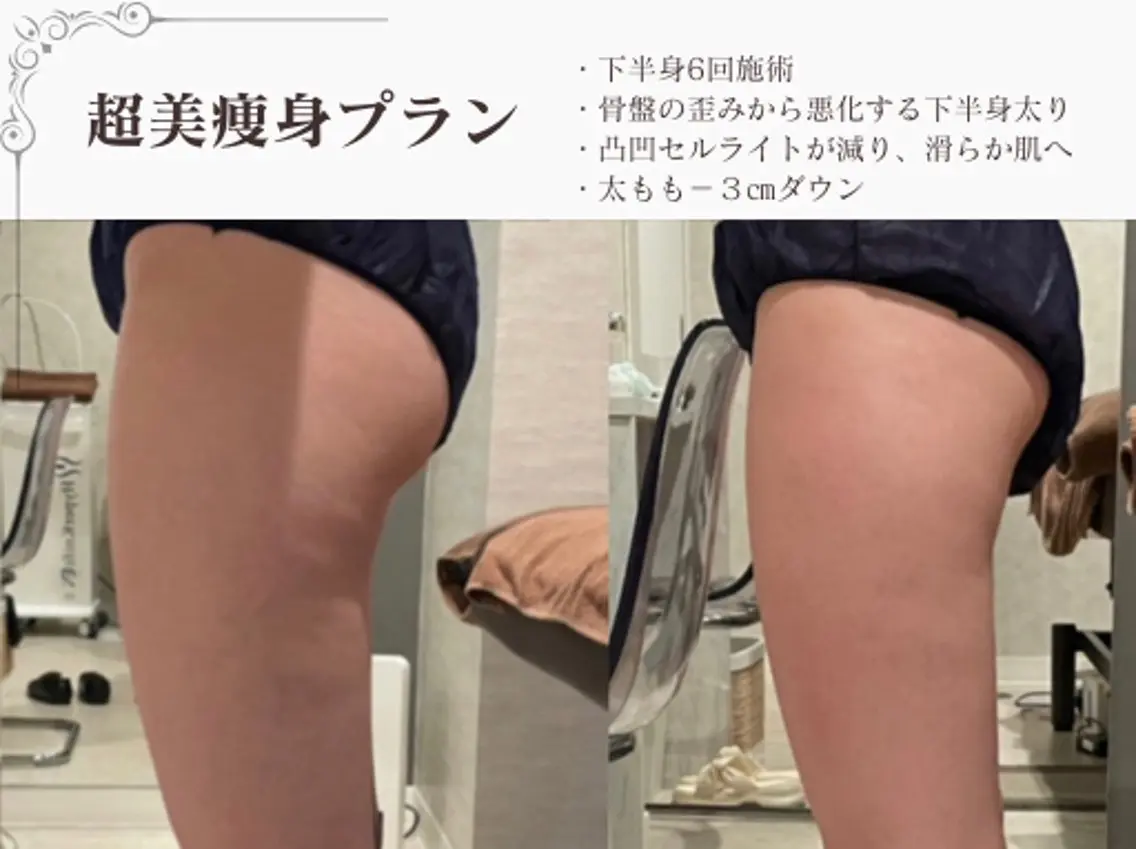 エステ リラク 総合美容サロン LOVEME渋谷本店のエステ・リラクイメージ
