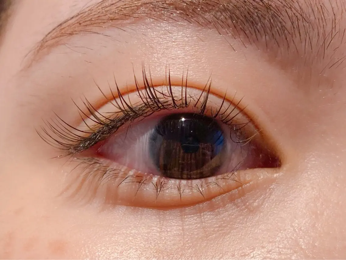 フラットラッシュ80本の写真