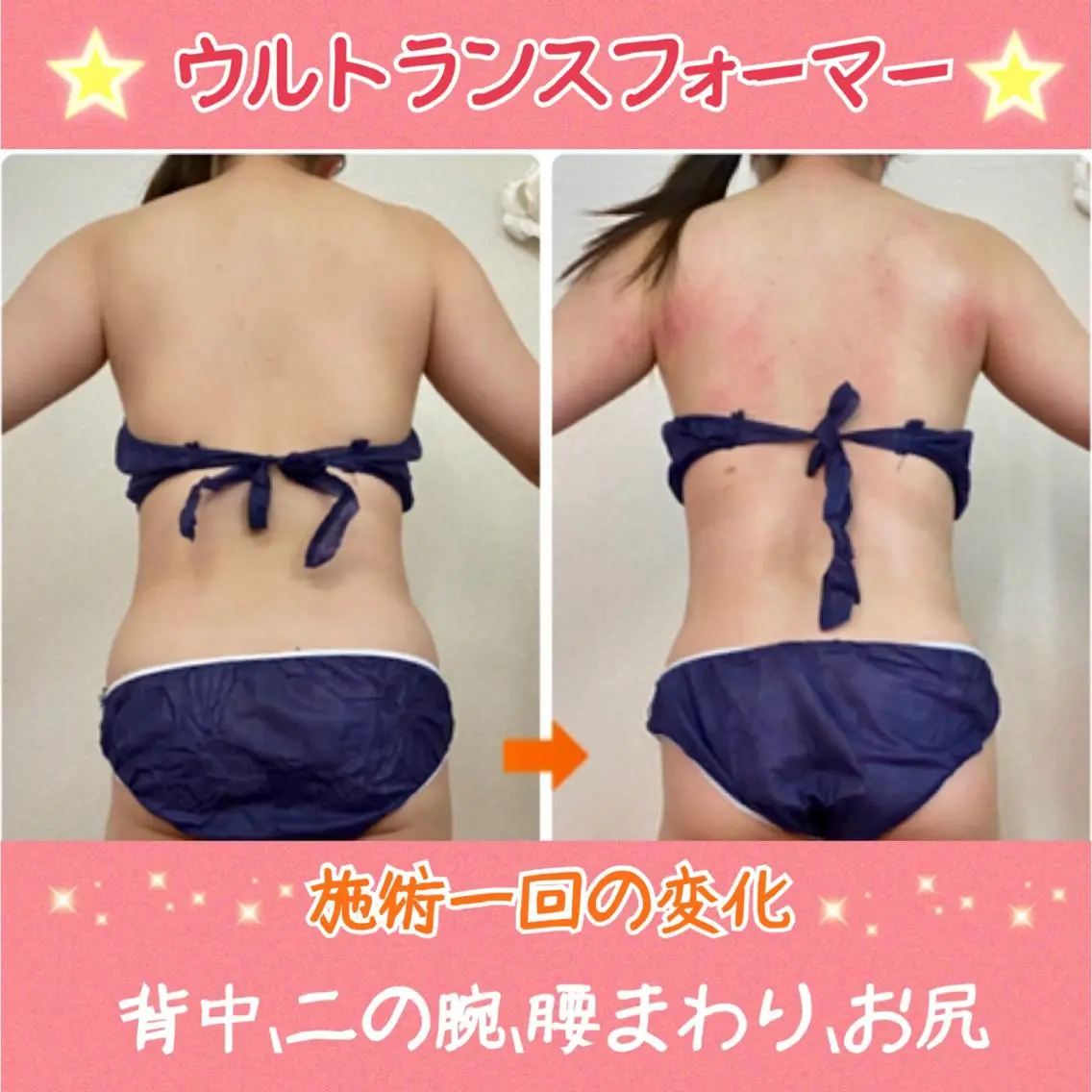 ショート カラー パーマ ヘアアレンジ メンズ キッズ ネイル マツエク・マツパ 赤色 痩身&ボディ 結果出し🌟丹野のエステ・リラクイメージ