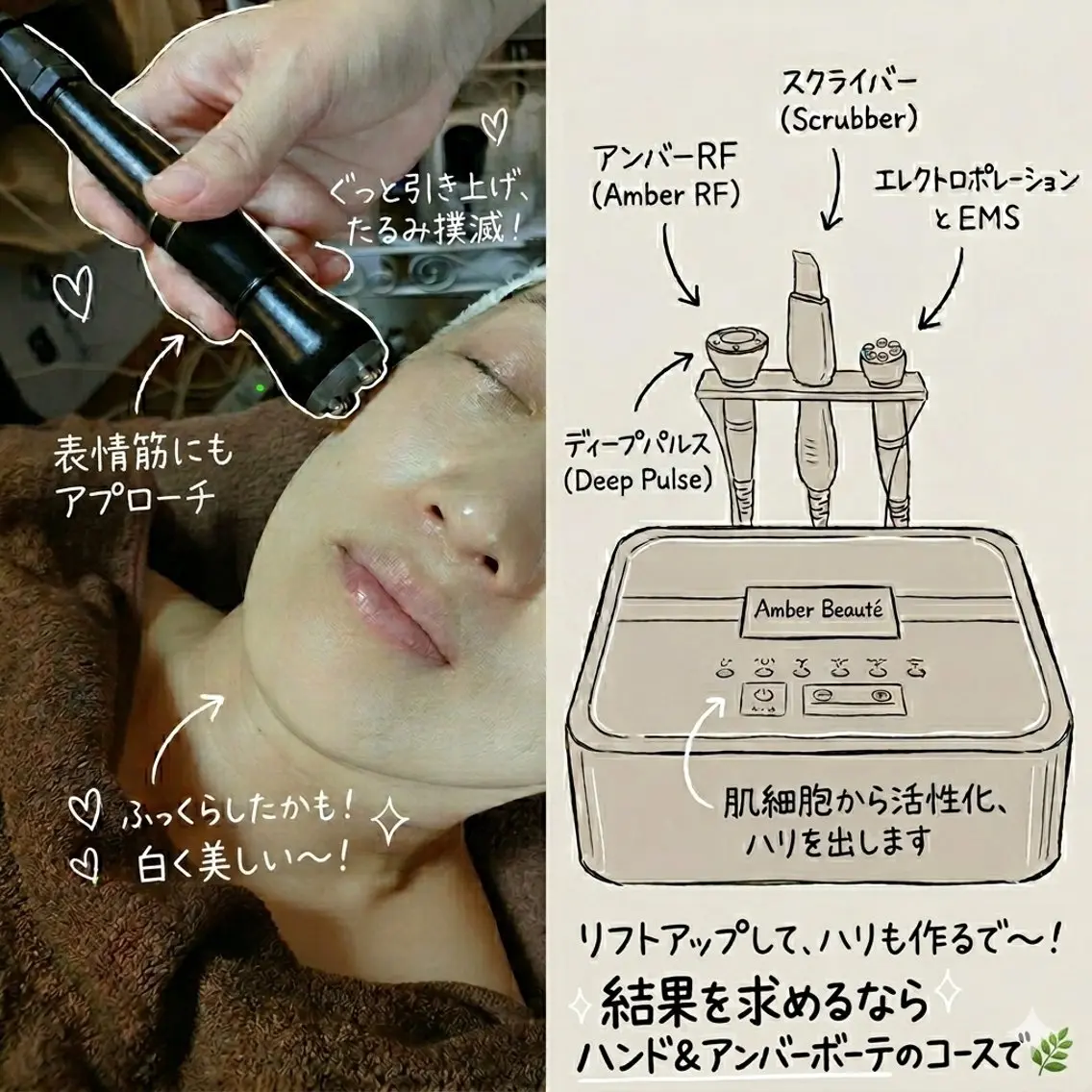 すっきりリフト小顔コースの写真