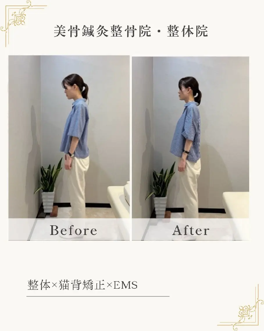 【つらい頭痛▪️眼精疲労の方♪】根本改善整体の写真