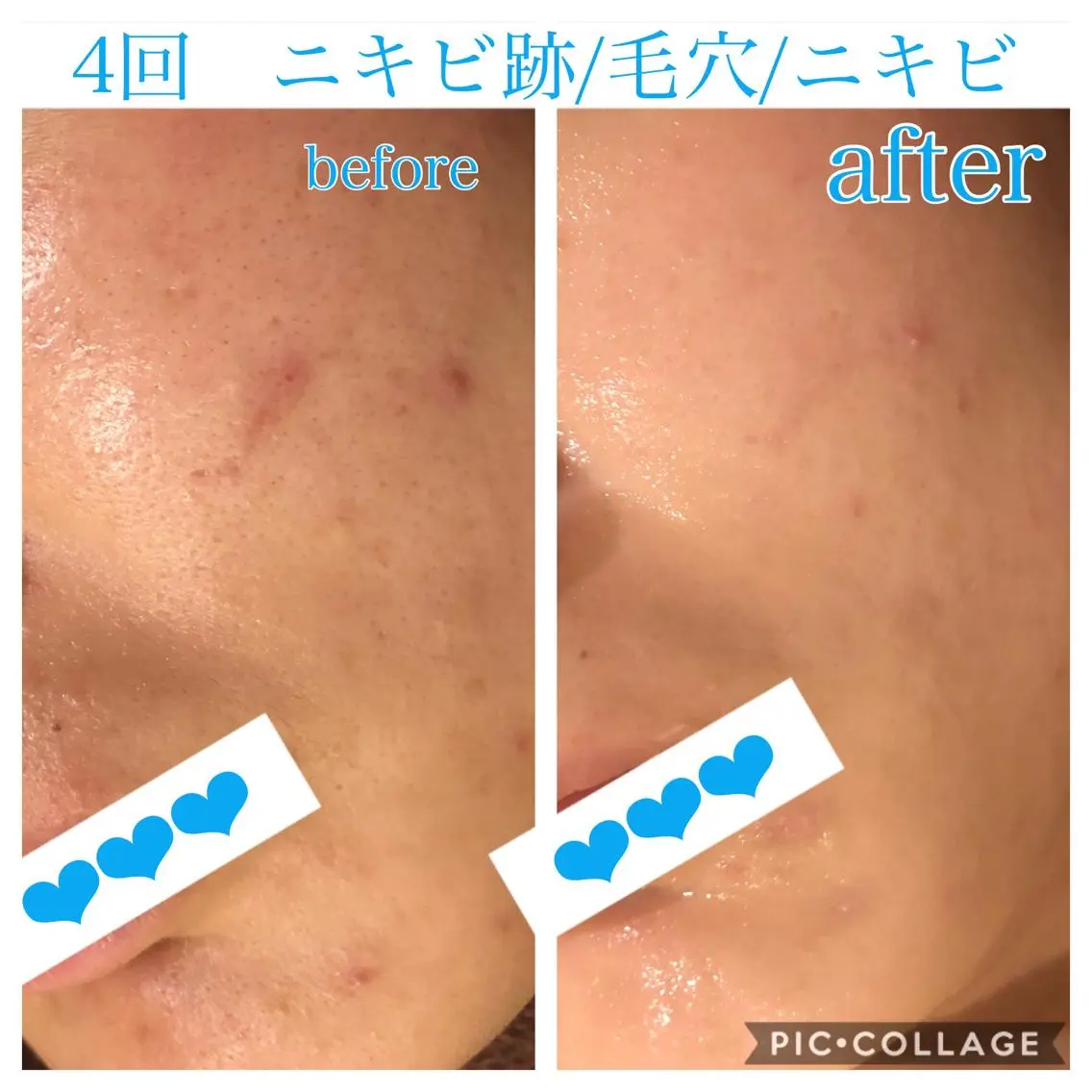 ロング カラー パーマ ヘアアレンジ メンズ キッズ ネイル マツエク・マツパ エステ リラク EnsorClair 代表 野口真央のエステ・リラクイメージ