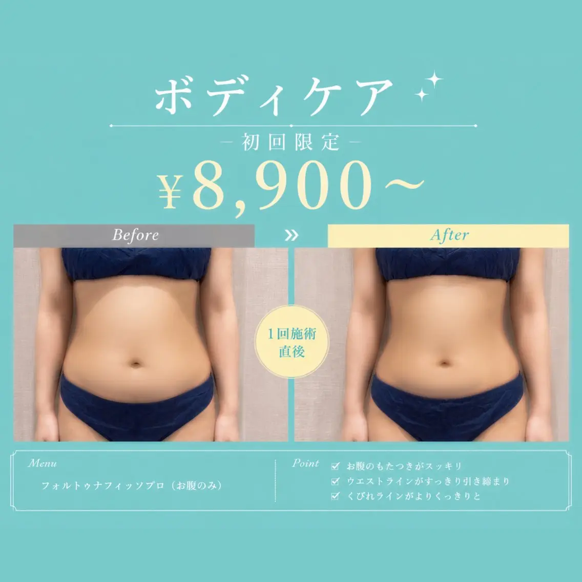 エステ Sky7 Total Beautyのその他イメージ