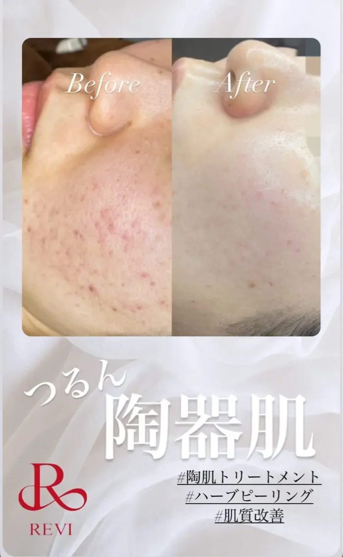 Lattina ラティーナのエステ・リラクイメージ