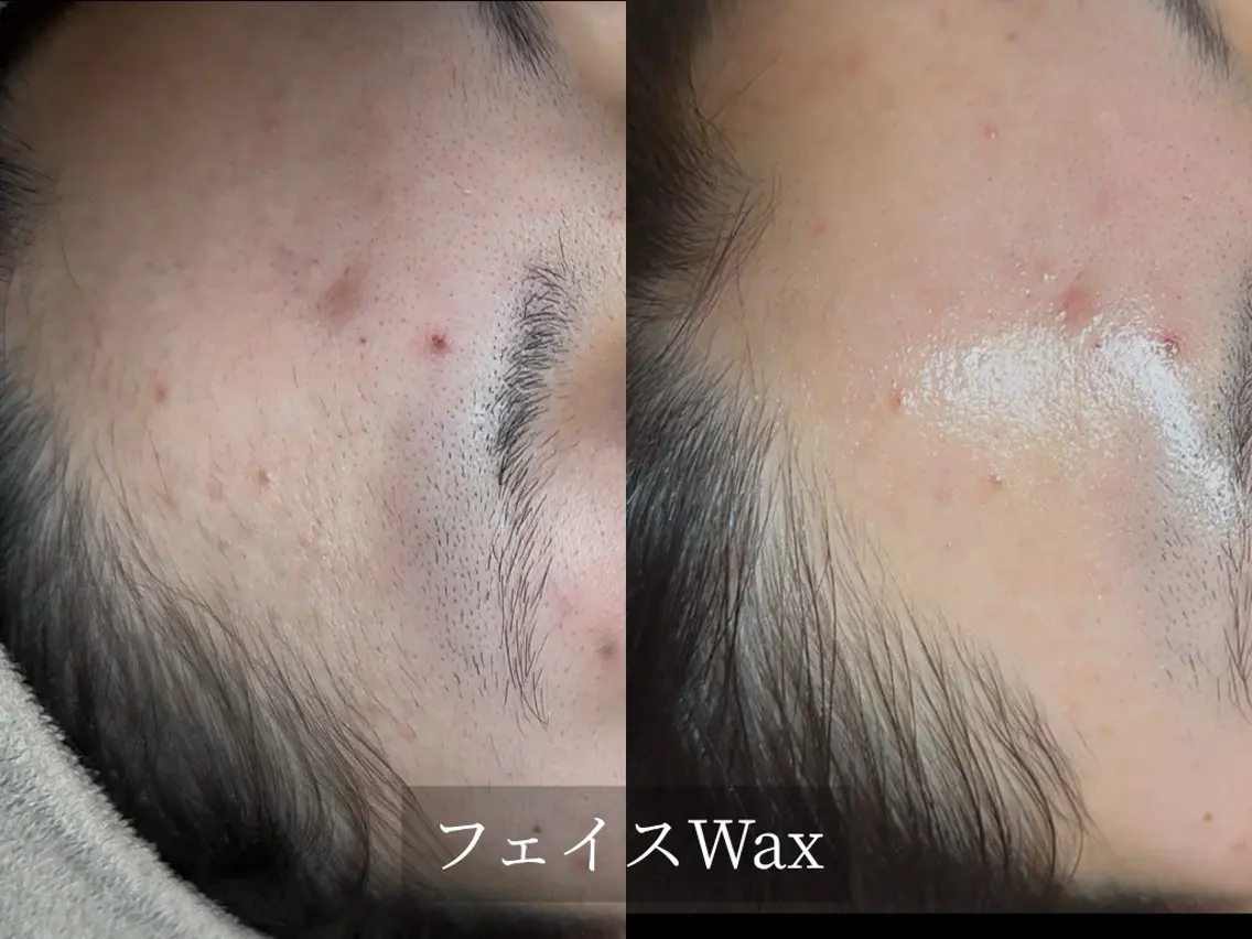 脱毛サロン Arumのエステ・リラクイメージ