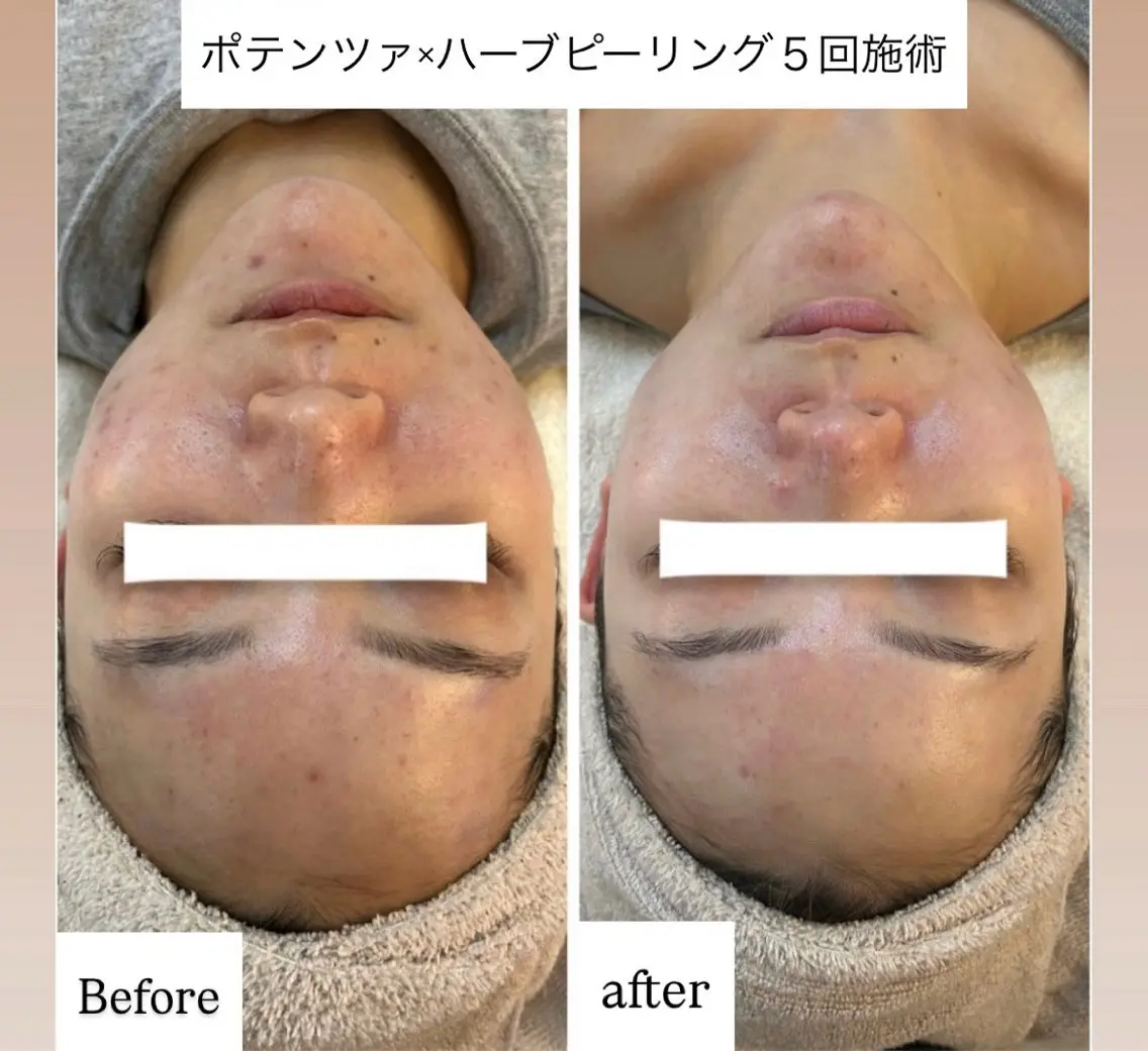 エステ 肌管理 OGUMOのエステ・リラクイメージ