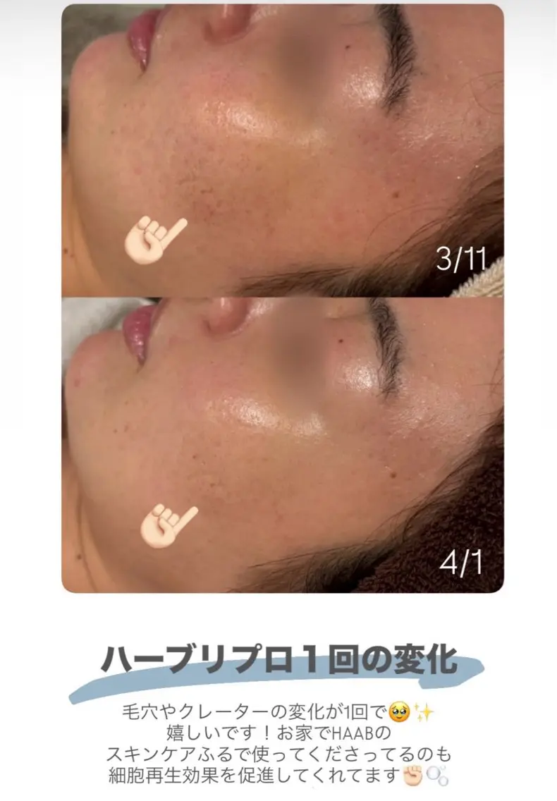 エステ Salon de coco/肌質改善のエステ・リラクイメージ