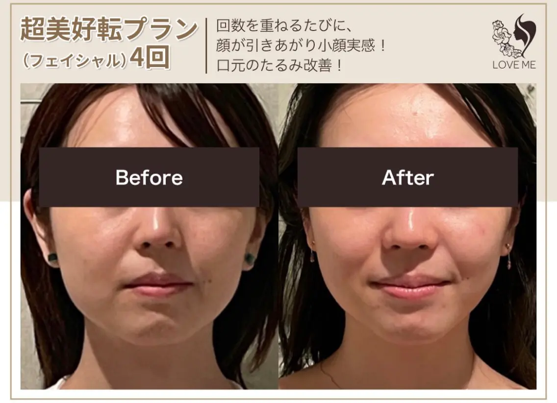 総合美容サロン LOVEME渋谷本店のエステ・リラクイメージ