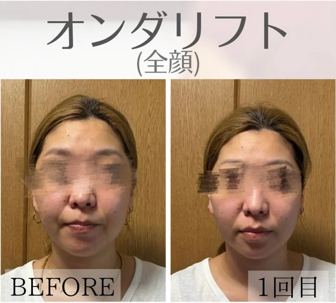 オンダリフト小顔× 痩身・美肌ケアのエステ・リラクイメージ