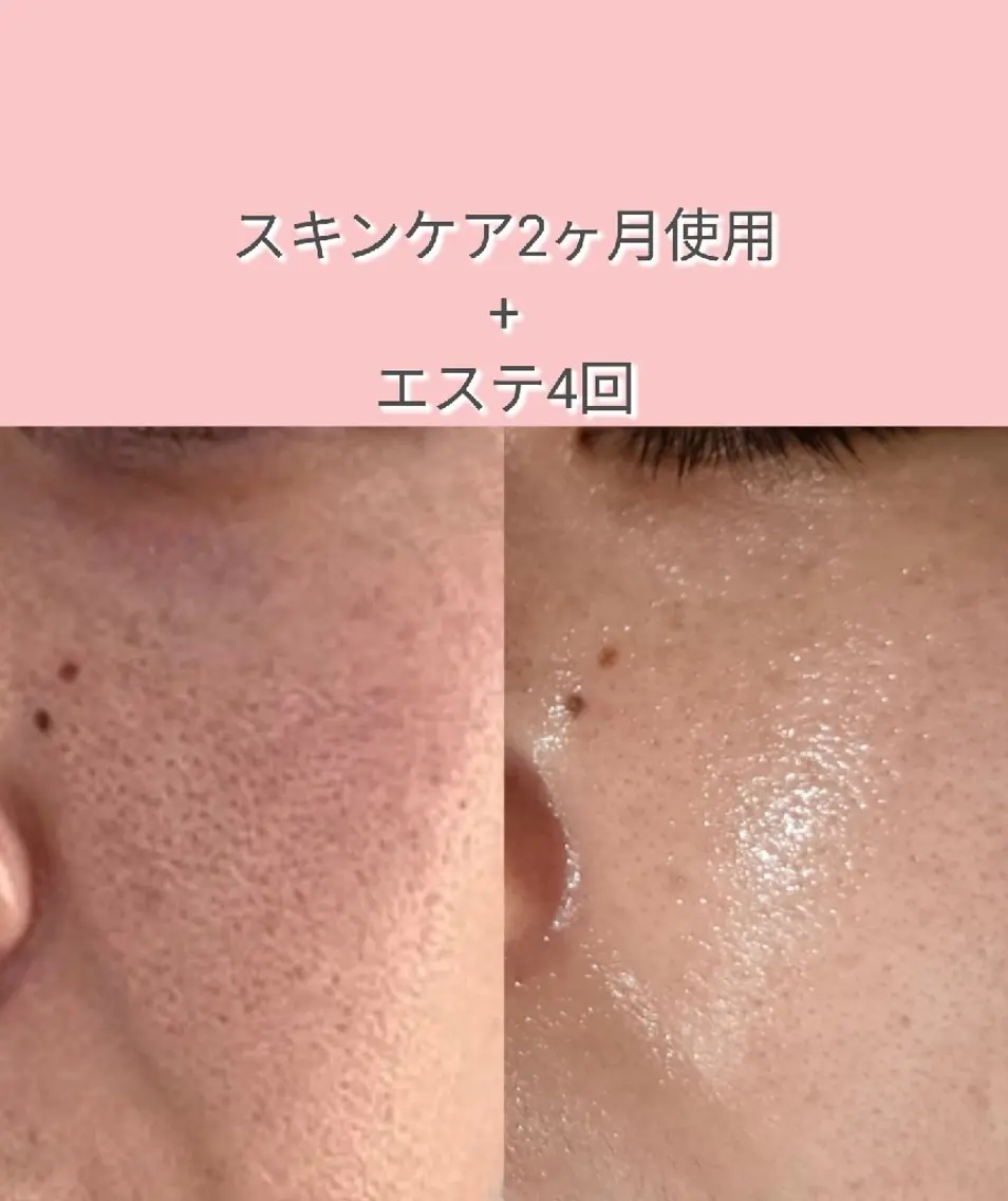 【カウンセリング.お土産付き🎁】お肌の相談だけでも大歓迎 ܀ꕤ୭*ご予約、ご来店お待ちしてます。の写真