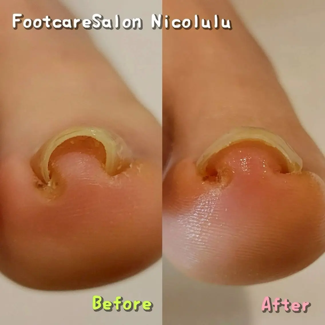 Nicolulu 金沢店のエステ・リラクイメージ