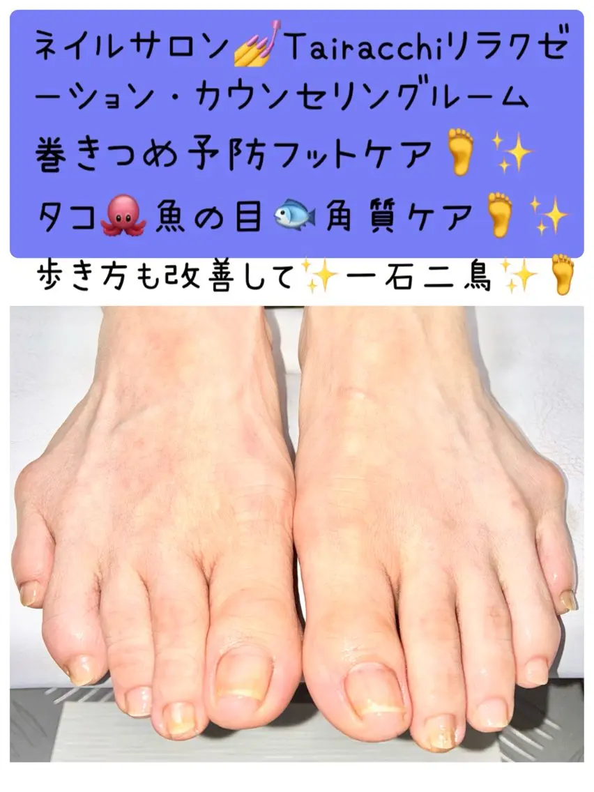 ネイル フットネイル Tairacchi タイラッチのネイルデザイン