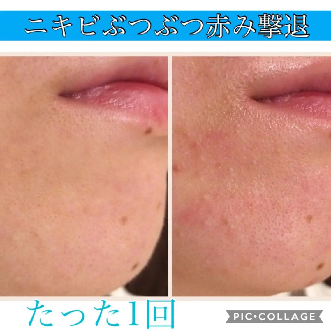 セミロング カラー パーマ ヘアアレンジ キッズ ネイル マツエク・マツパ エステ リラク EnsorClair 代表　野口真央のエステ・リラクイメージ