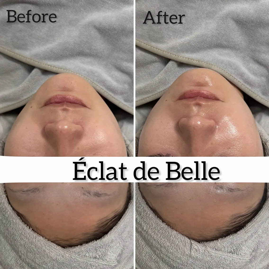 エステ Éclat de Belle🫧白玉肌のその他イメージ