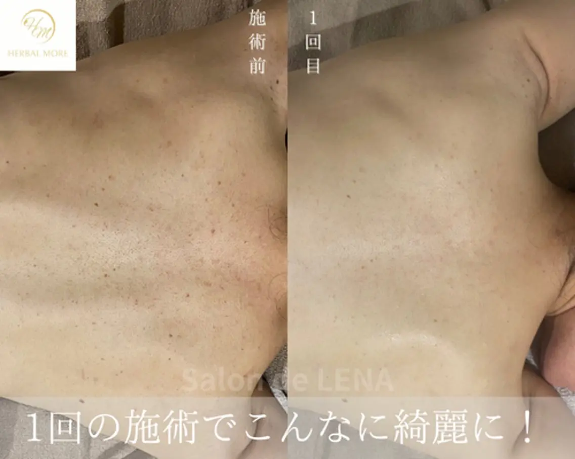 エステ ハーブピーリング専門 サロンドレナ平岡のエステ・リラクイメージ