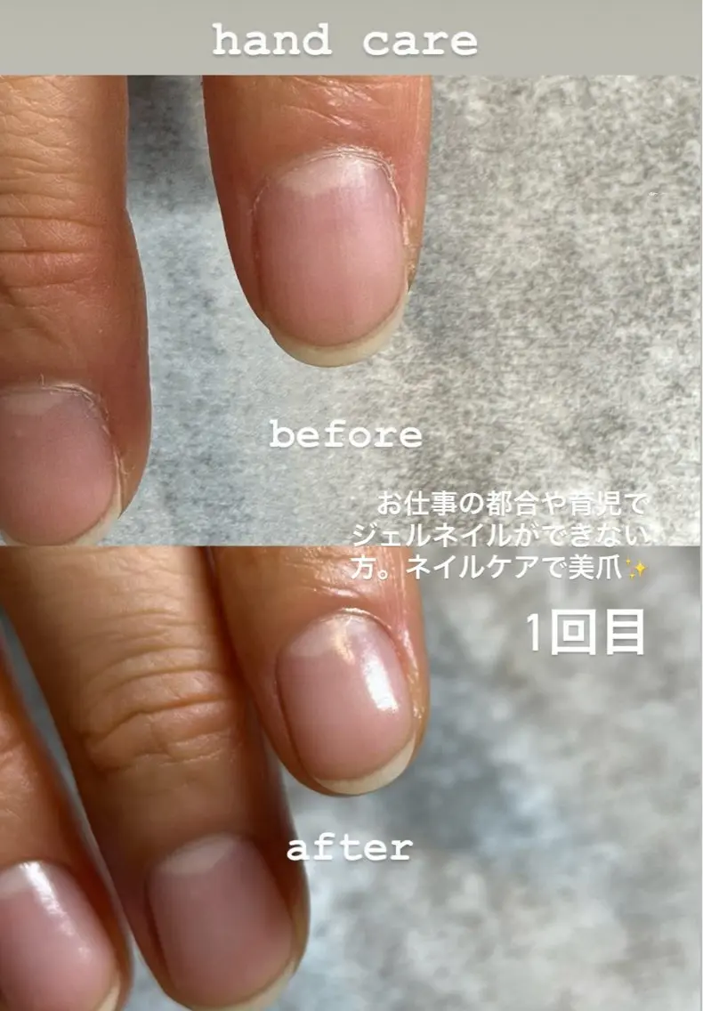 自爪美ネイルケアの写真