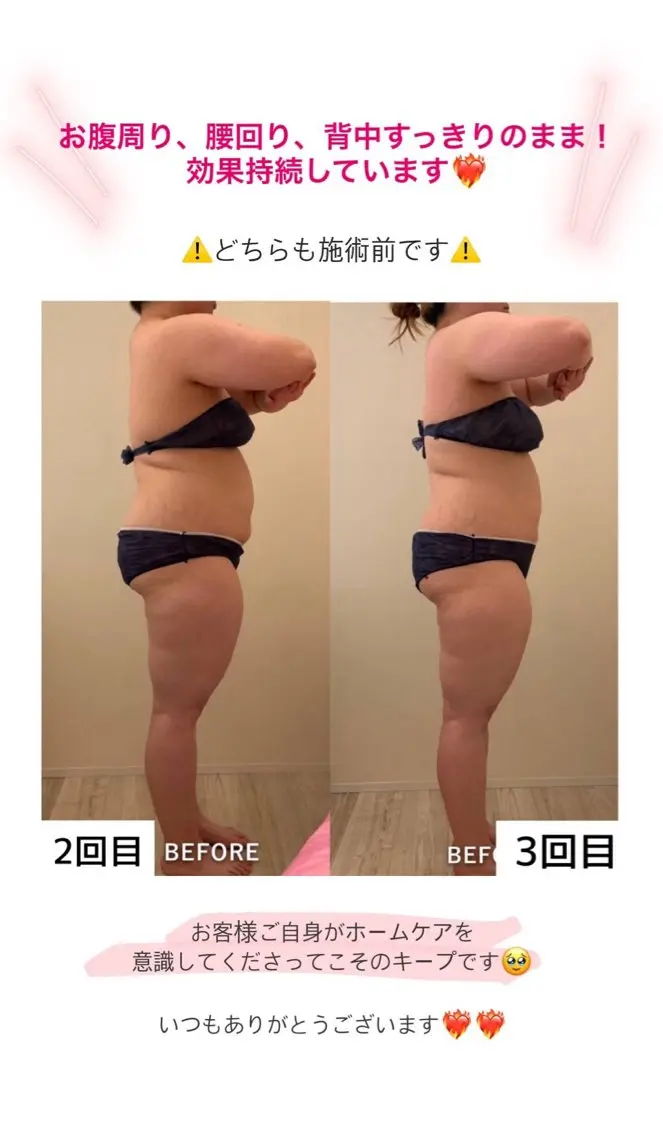 産後ダイエット−9㎏ Pourvous結衣のエステ・リラクイメージ