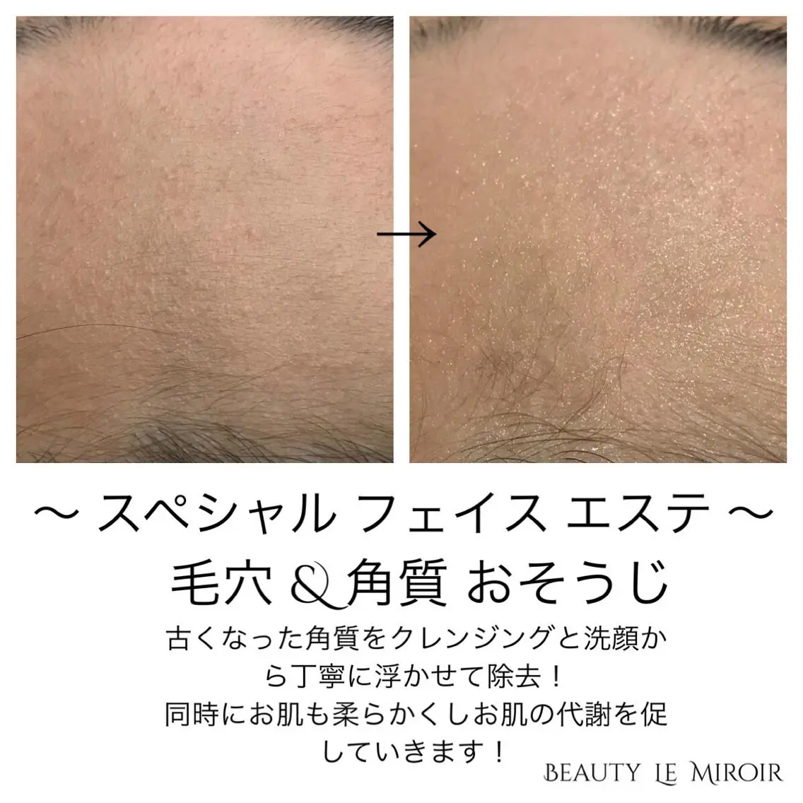 ビューティー ミロワールのエステ・リラクイメージ