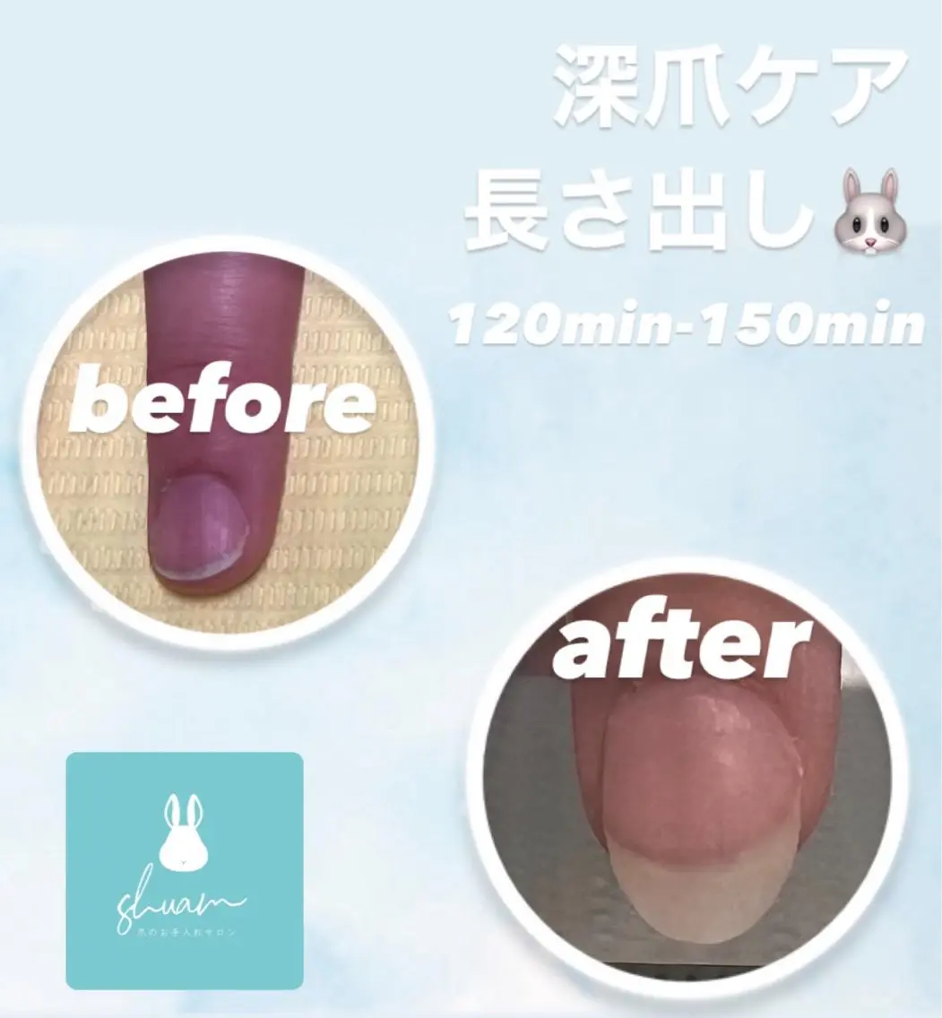 メンズ ネイル ハンドネイル 爪ケア/深爪 自爪育成 🐰えむのネイルデザイン