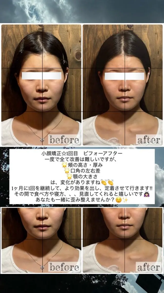 エステ リラク 💎後悔させない小顔 矯正💎イトヤマ🌱のエステ・リラクイメージ