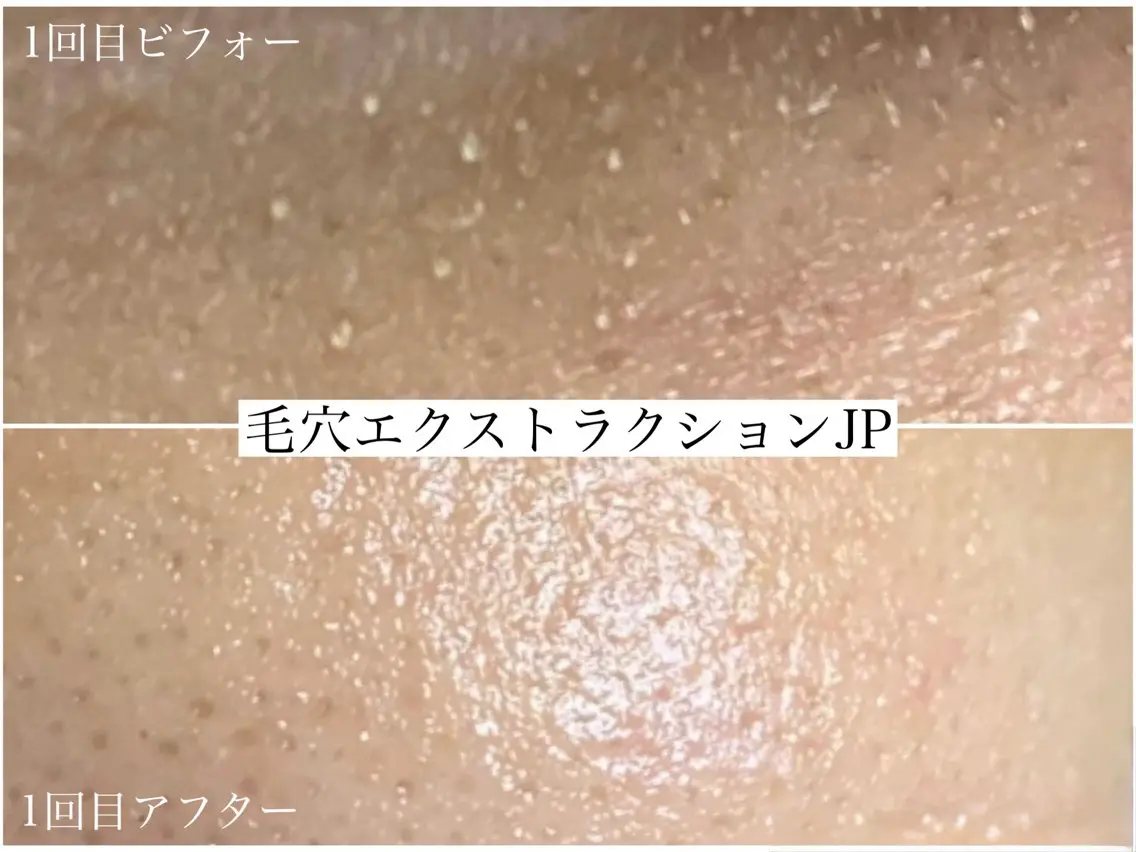 エステ 佐々木 風奈のエステ・リラクイメージ