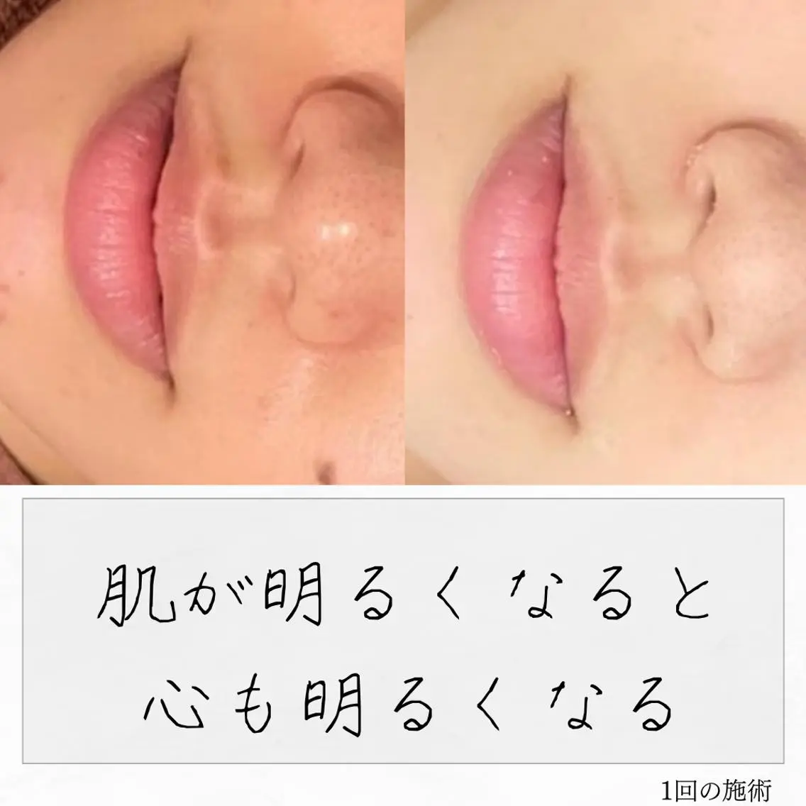 ニキビ経験者が施術 する専門サロン🌻のエステ・リラクイメージ