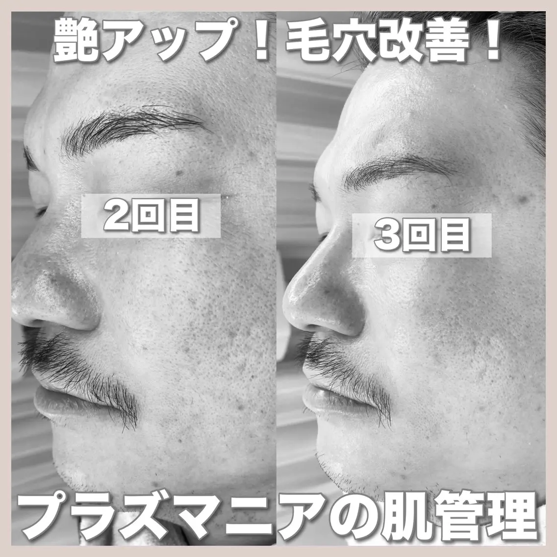 エステ mone (モーネ)のエステ・リラクイメージ
