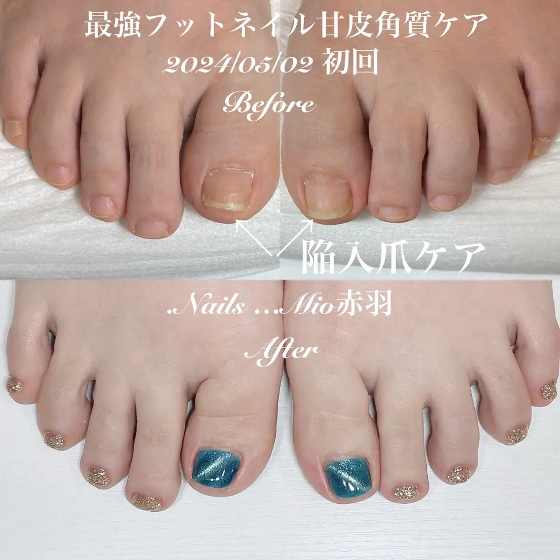 ネイル フットネイル .Nails Mio 赤羽西ネイルサロンのネイルデザイン