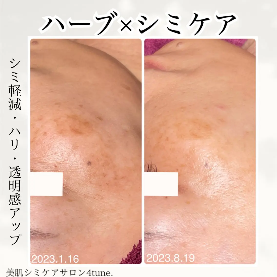 美肌シミケアサロン 4tune.RUMIのその他イメージ