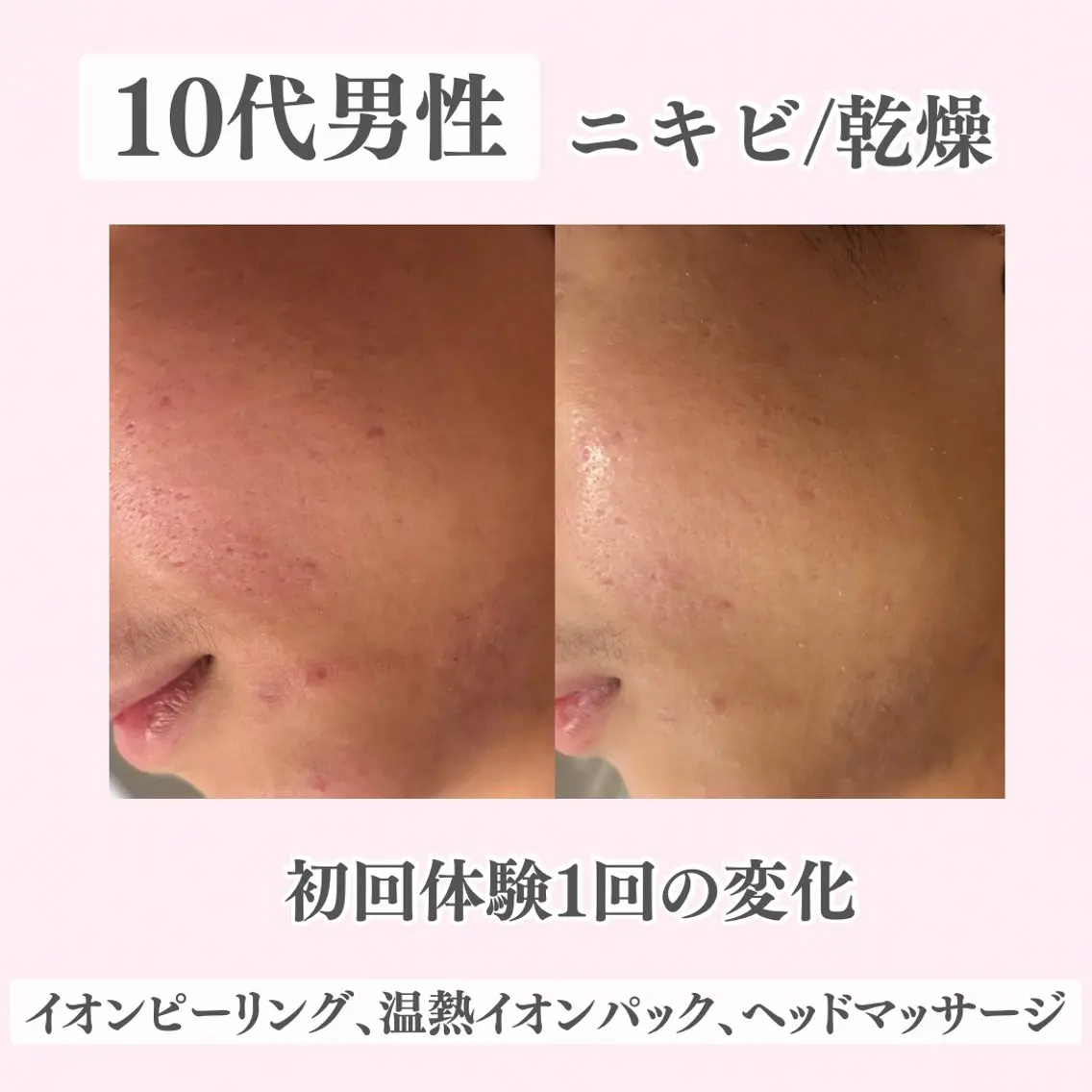 エステ リラク ニキビ・肌質改善専門 ♡人生が変わるサロンのエステ・リラクイメージ