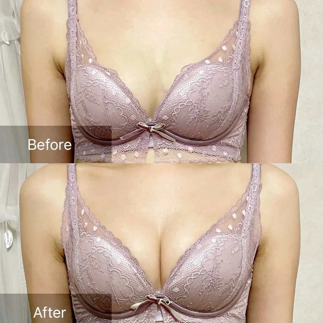 写真モニター価格【下垂/離れ乳改善】上半身＆バストマッサージ＋美乳マシーン初回体験の写真