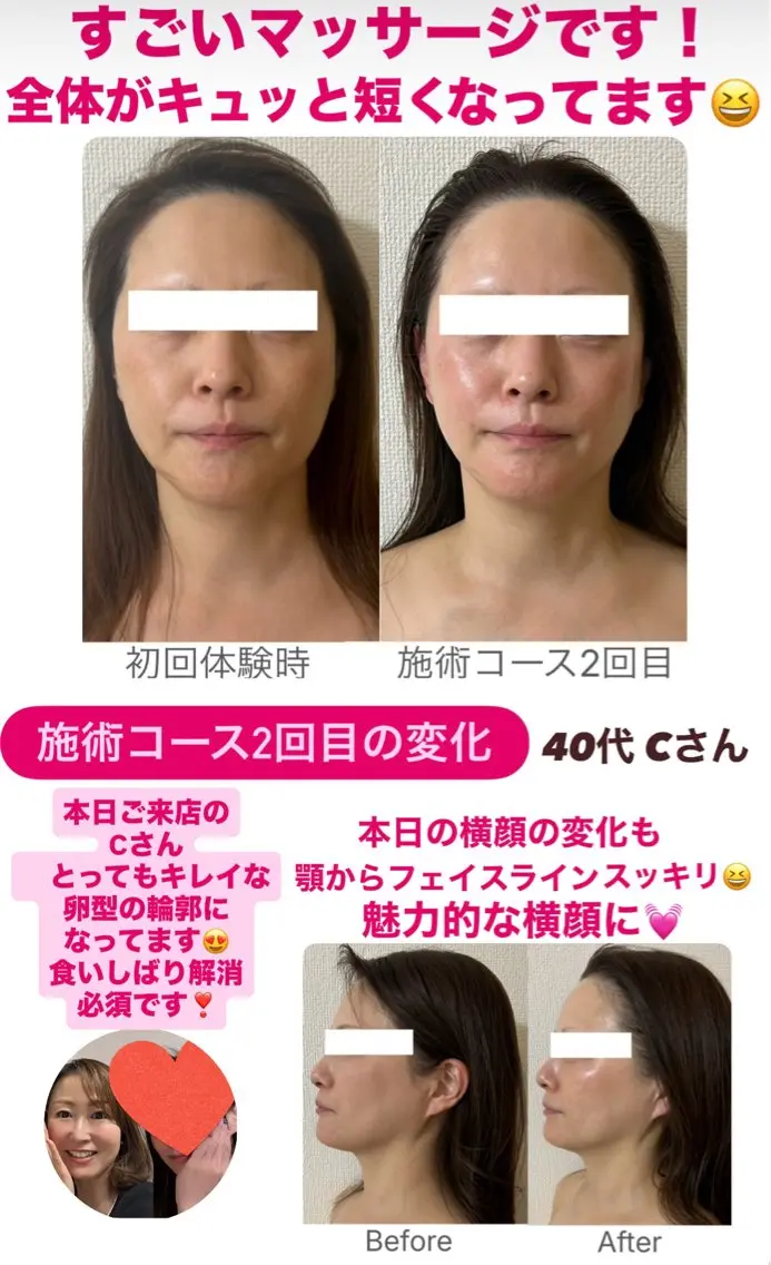 小顔サロン (ラ リュミエール)のエステ・リラクイメージ