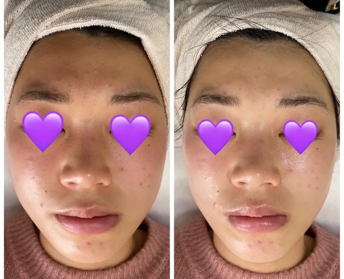 エステ COCO beautyサロンのエステ・リラクイメージ