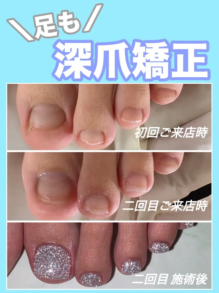ネイル フラッシュネイル フットネイル nail salon petillantのネイルデザイン