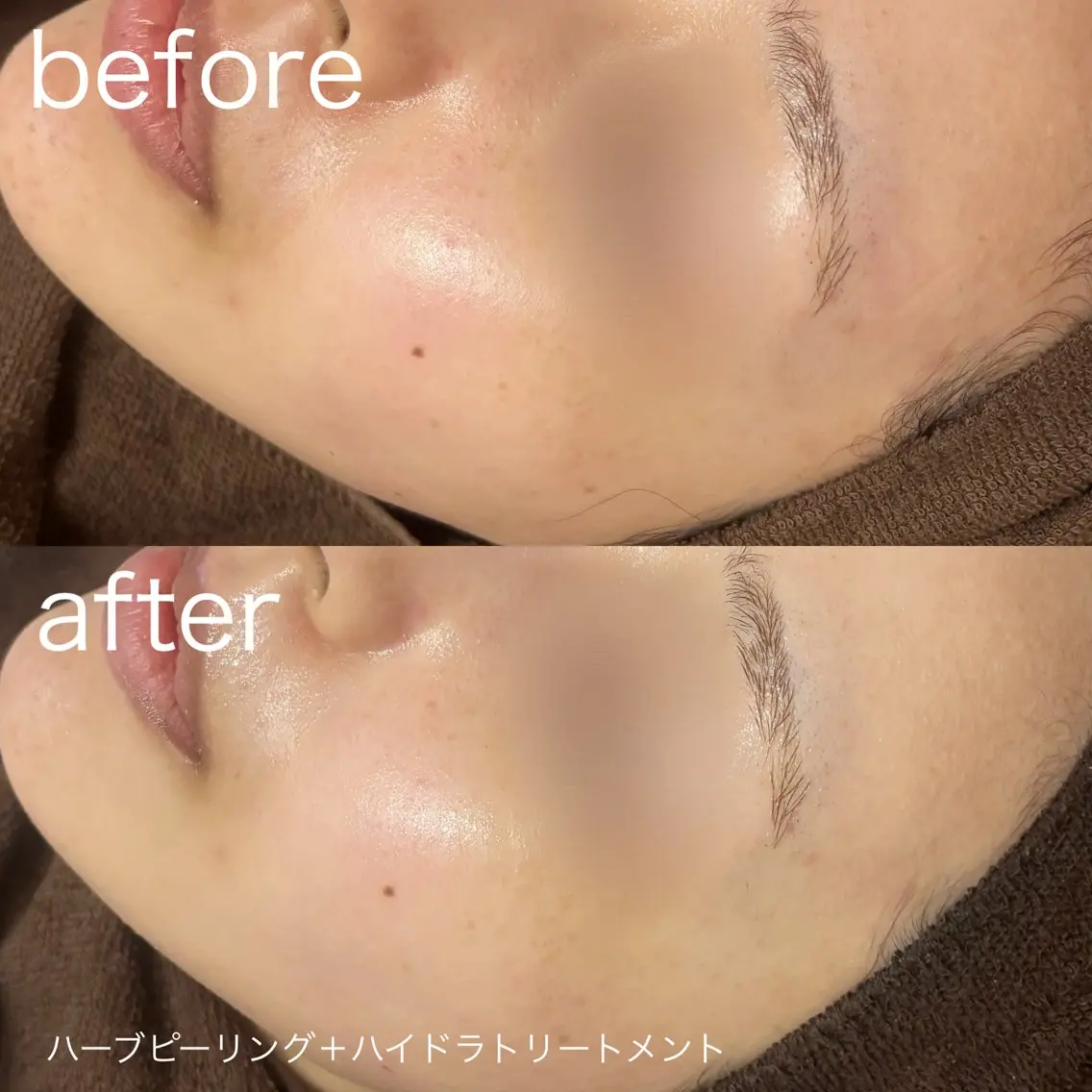 脱毛 lulularico Yuのネイルデザイン