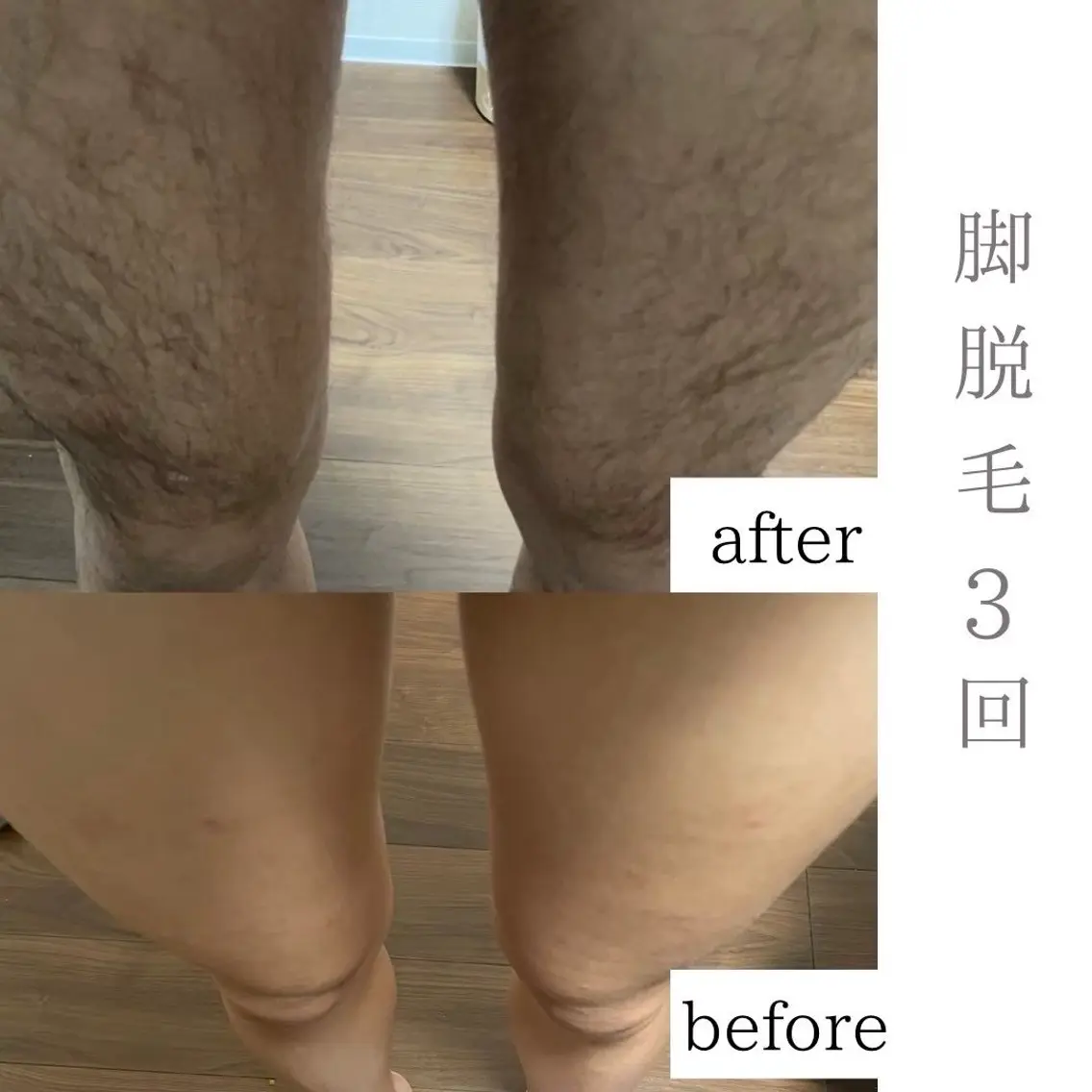 脱毛 三浦 理紗子のエステ・リラクイメージ
