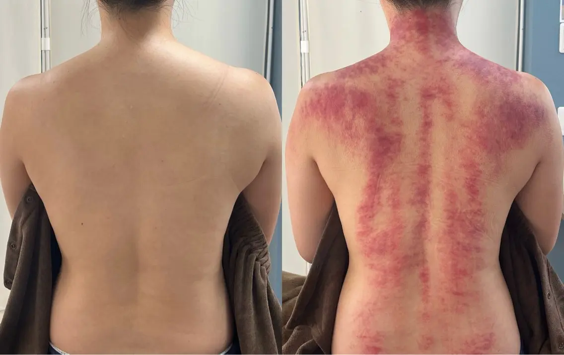 【新感覚デトックスケア】東洋医学全身カッサの写真