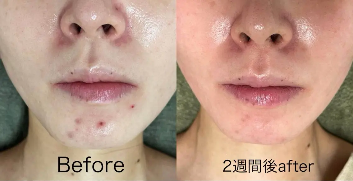エステ salon de jessicaのエステ・リラクイメージ