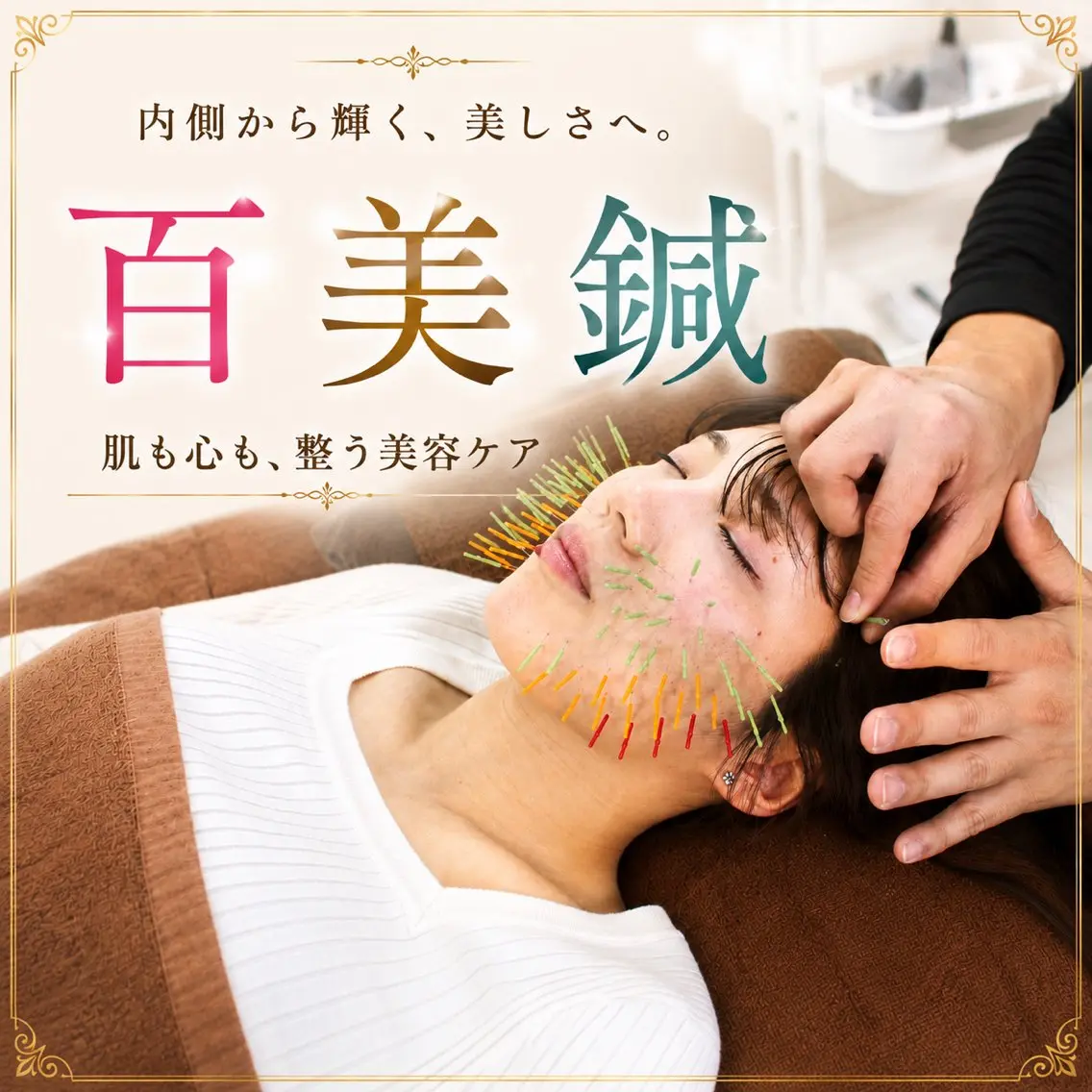 【人気メニューNo.3】百美鍼:美容鍼100本(リフトアップ/小顔/ほうれい線/しわ/たるみ/毛穴の開き)(70分)の写真