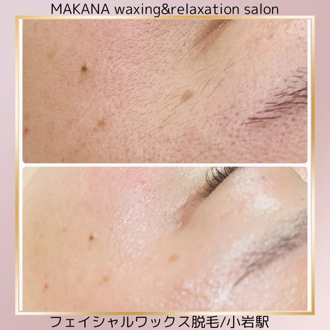 MAKANA 吉岡 小岩店のエステ・リラクイメージ