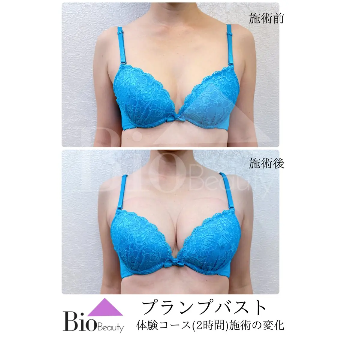 エステ エステ豊胸マイスター 中前のエステ・リラクイメージ